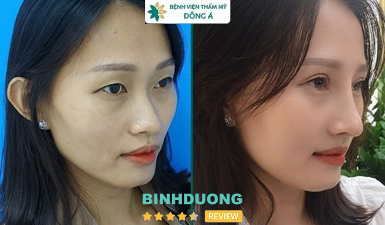 Bệnh viện thẩm mỹ Đông Á tại Bình Dương