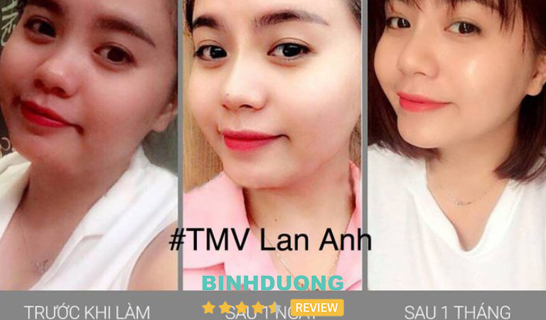 Viện thẩm mỹ Lan Anh tại Bình Dương