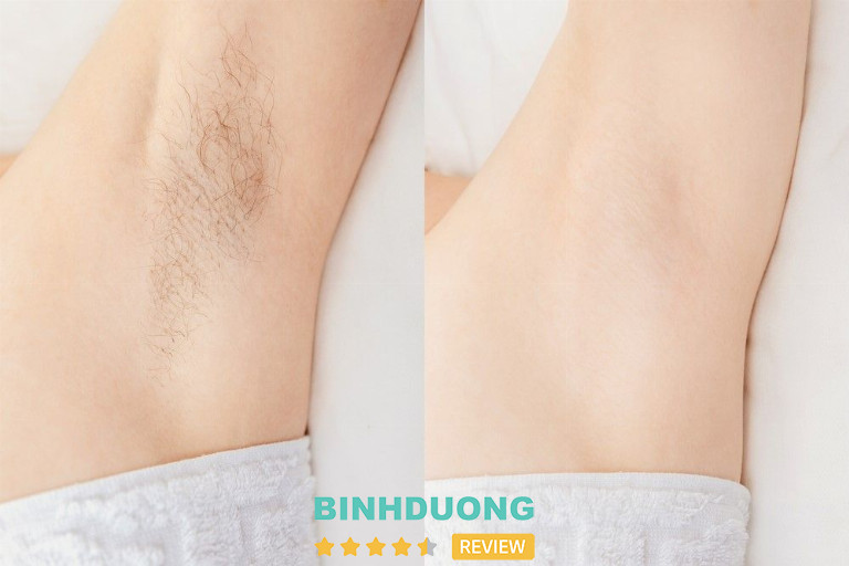 Spa Tôn Thị, H. Bàu Bàng.