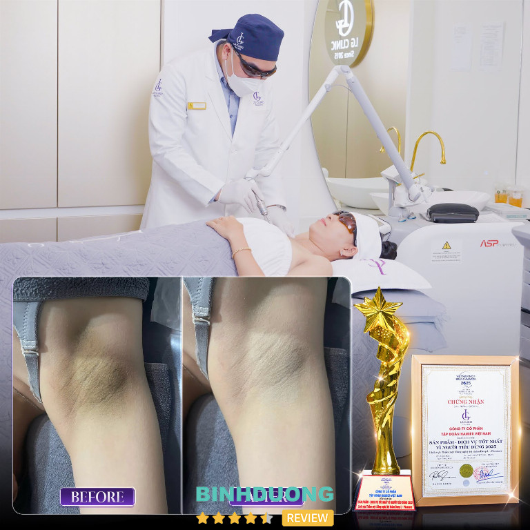 trị thâm nách tại LG Clinic trị thâm nách tại LG Clinic