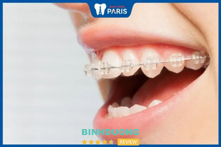 Nha khoa Paris, TP. Thủ Dầu Một