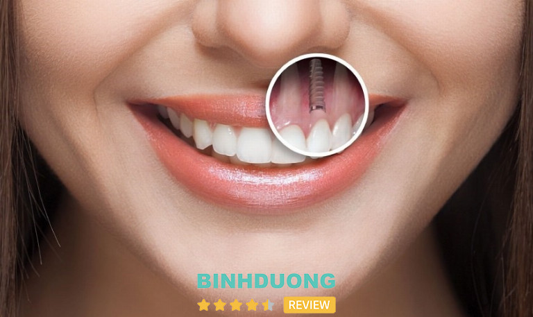 Nha khoa Việt Nha, Bình Dương