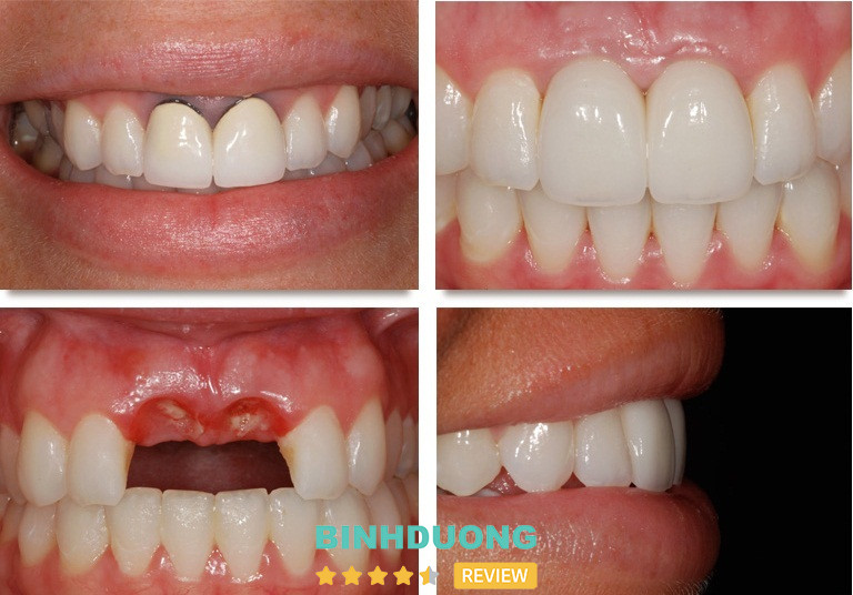 Nha khoa Bình Dương, Bình Dương