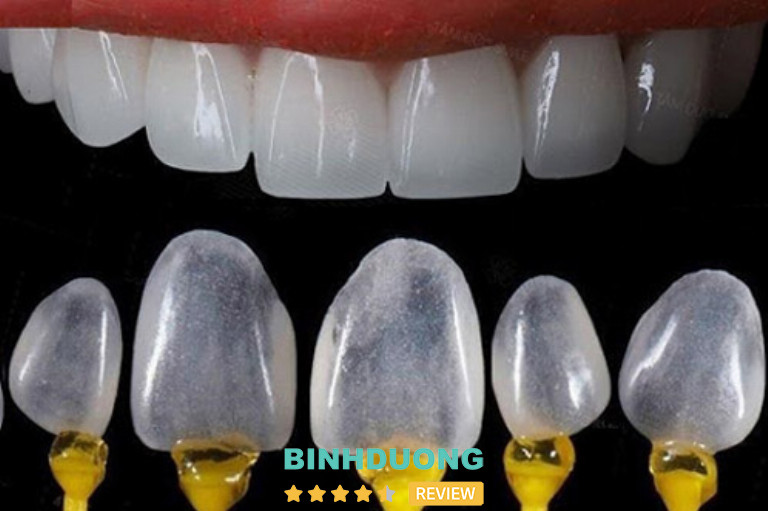 Nha Khoa Hoàn Mỹ, Bình Dương