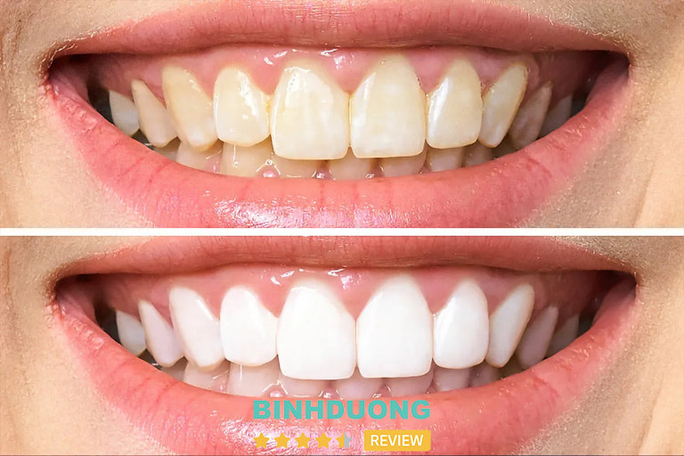 Lê Kha Dental, Bình Dương