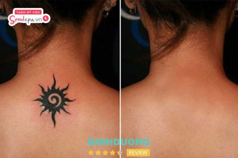 Thẩm mỹ viện SeoulSpa, Bình Dương