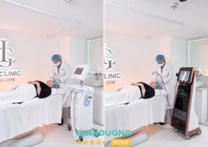 xoá nhăn ấn đường tại LG Clinic